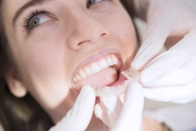 Imagem-Odontologia-alta-resolcao (42)