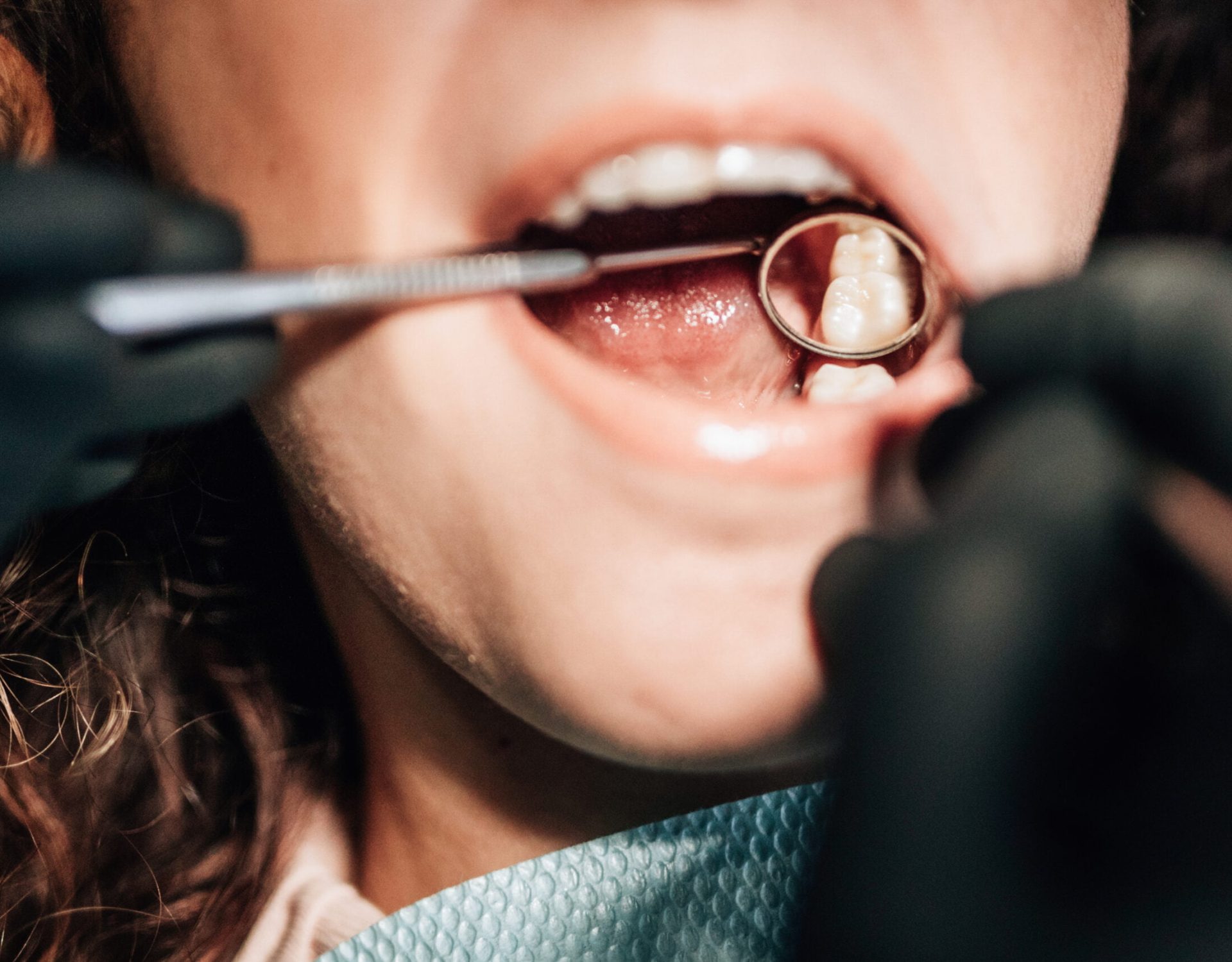 Imagem-Odontologia-alta-resolcao (329)