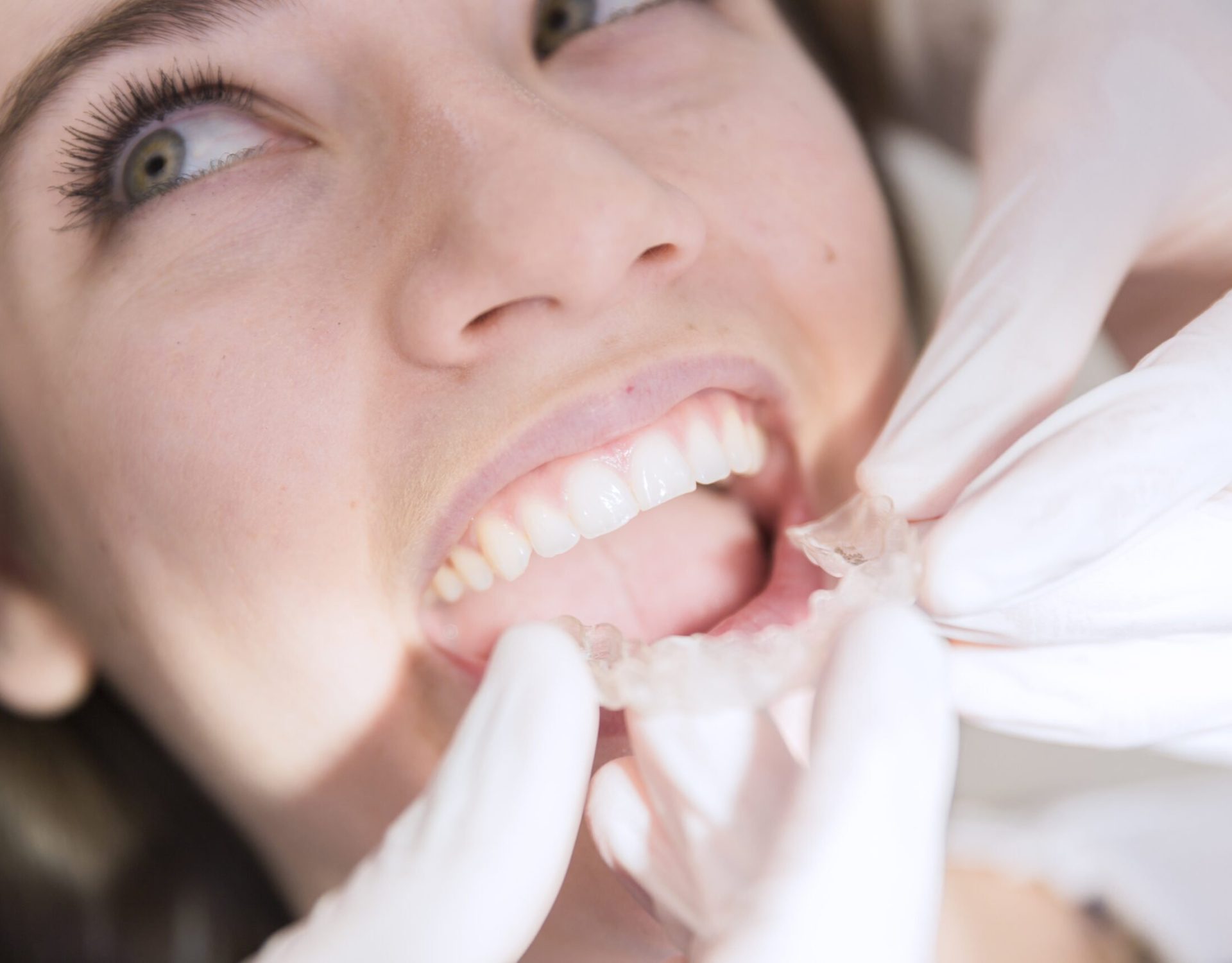 Imagem-Odontologia-alta-resolcao (42)